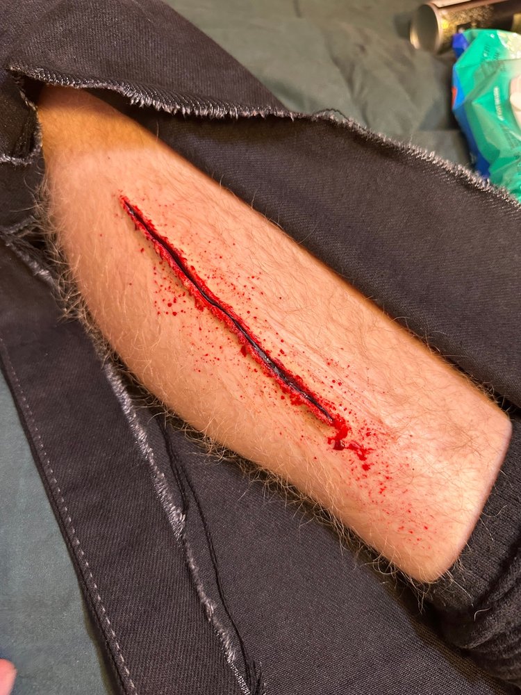 Prosthetic laceration effect on a forearm with blood spatter, built through a slashed costume sleeve